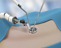 Minimally Invasive Surgical Solutions